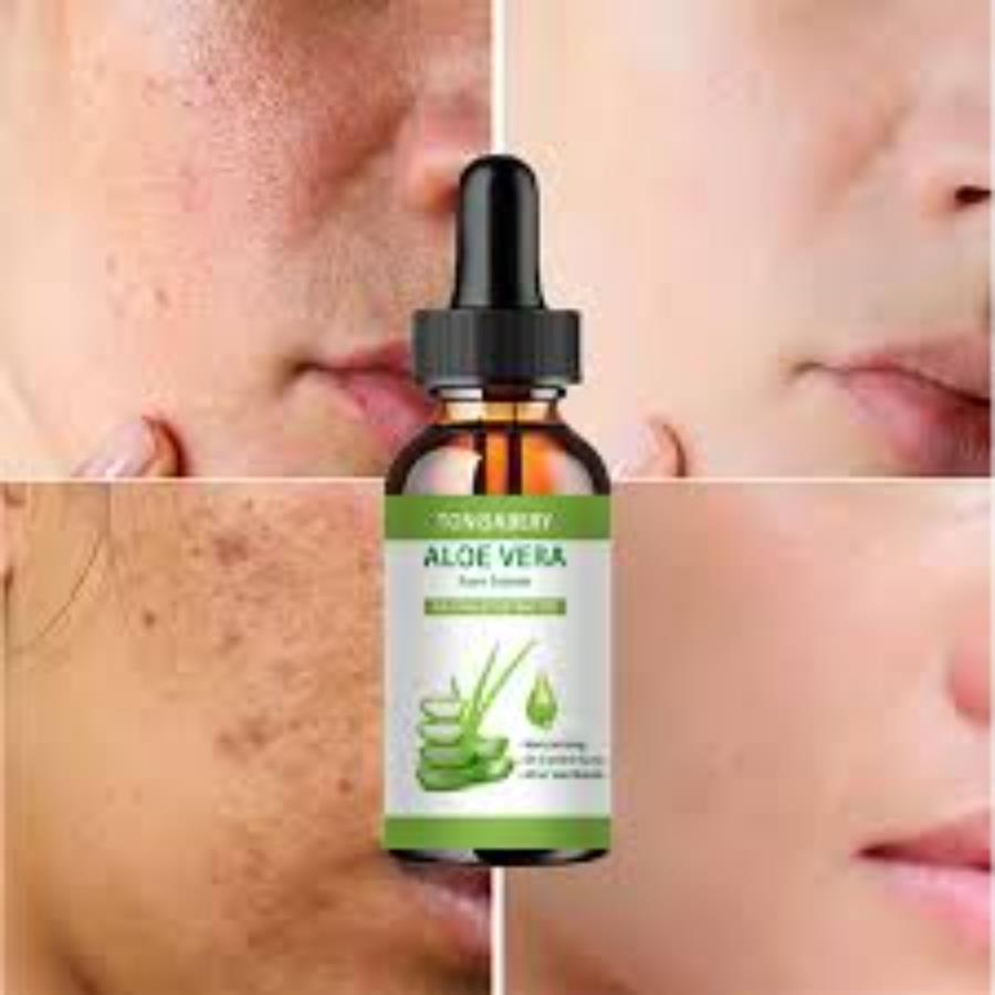 Aloe Vera Serum 98% Pure – Cuidado Intensivo para Pieles Muy Sensibles 🌱💧