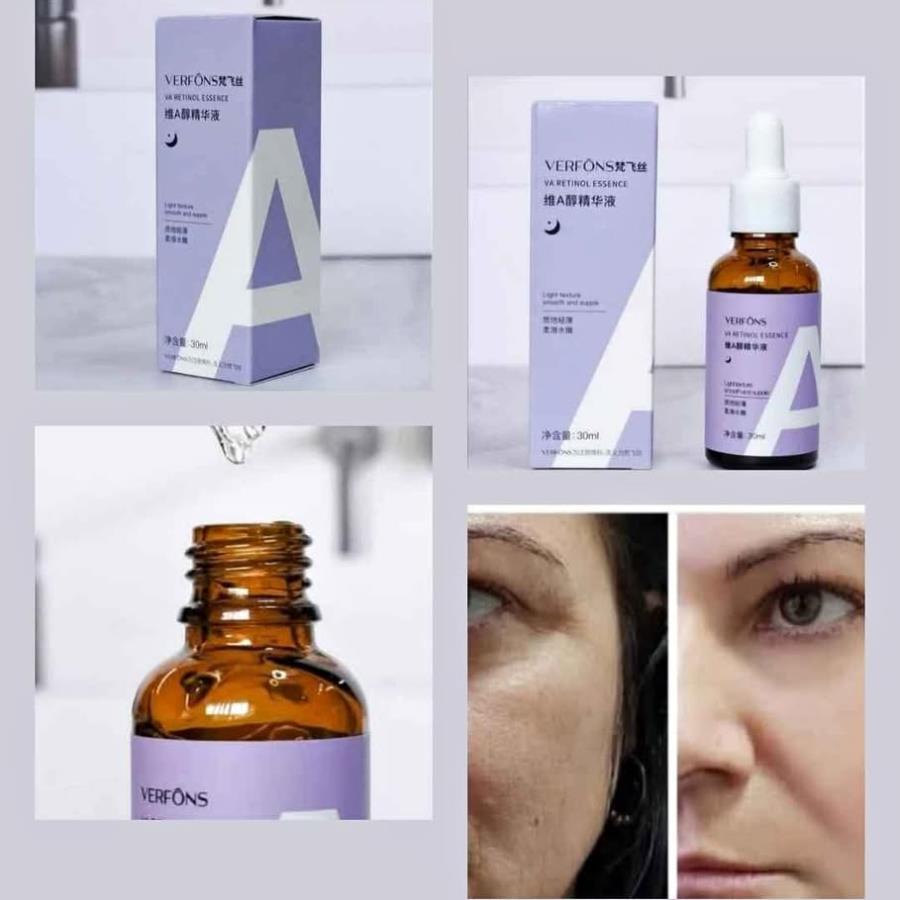 Verfons Esencia Facial con Retinol 30ml ✨💜 — Renovación Celular y Piel Rejuvenecida